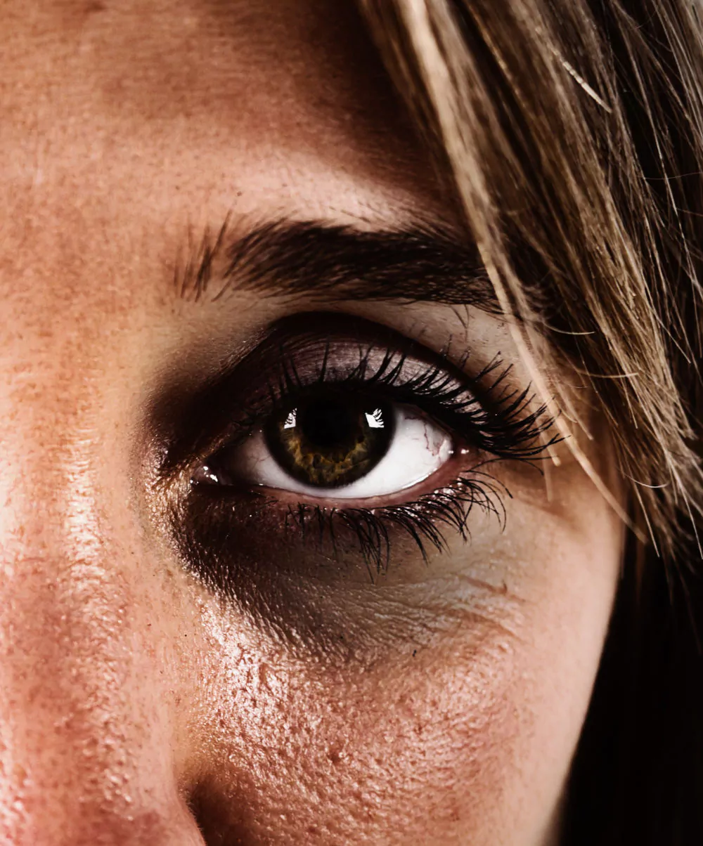 Eye bags and dark circles under eyes treatment: help reduce puffy