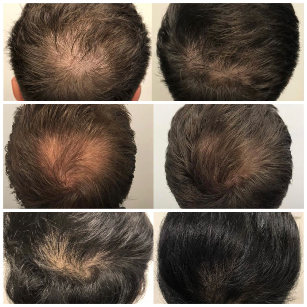 Before & Afters - Hair & Skin Science