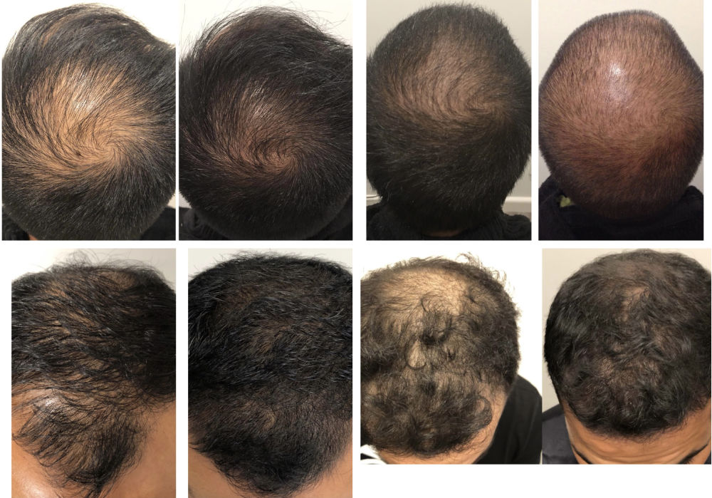 Before & Afters - Hair & Skin Science