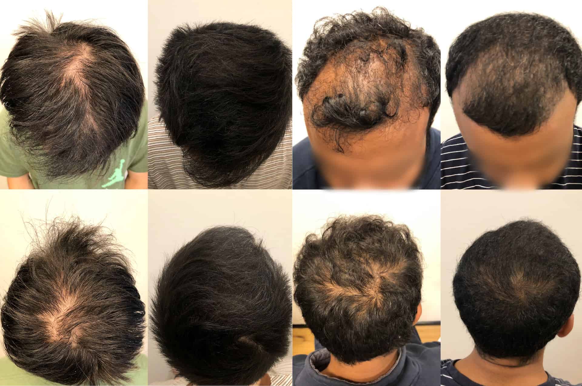 Before & Afters - Hair & Skin Science