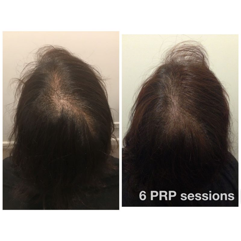 Before & Afters - Hair & Skin Science