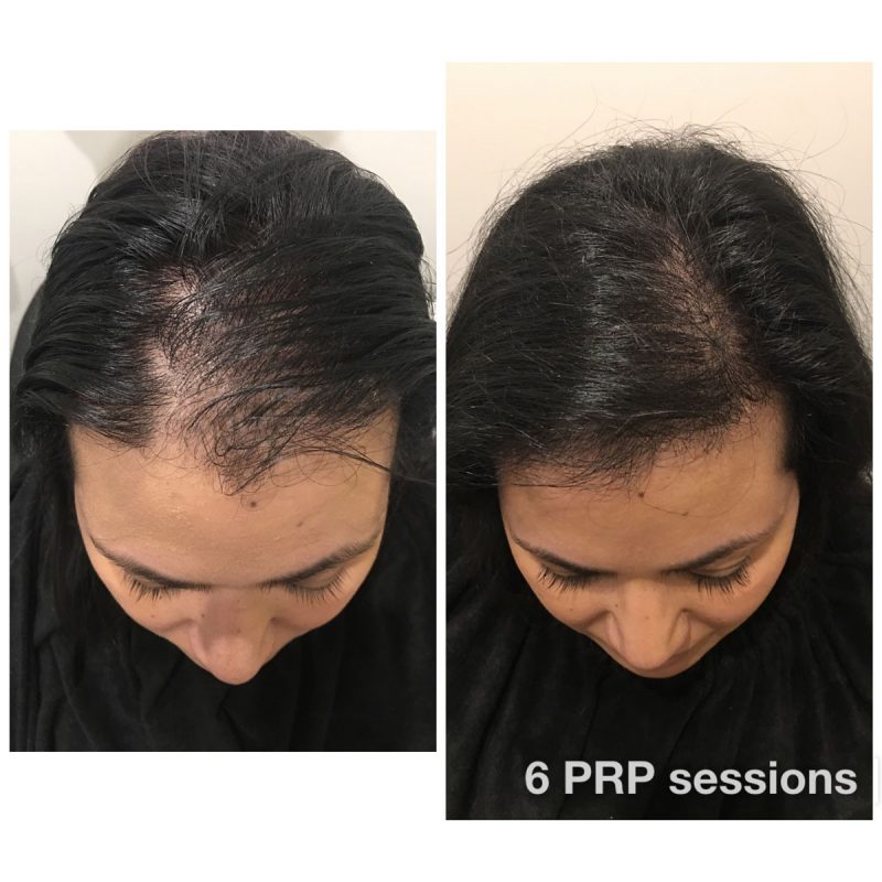 Before & Afters - Hair & Skin Science