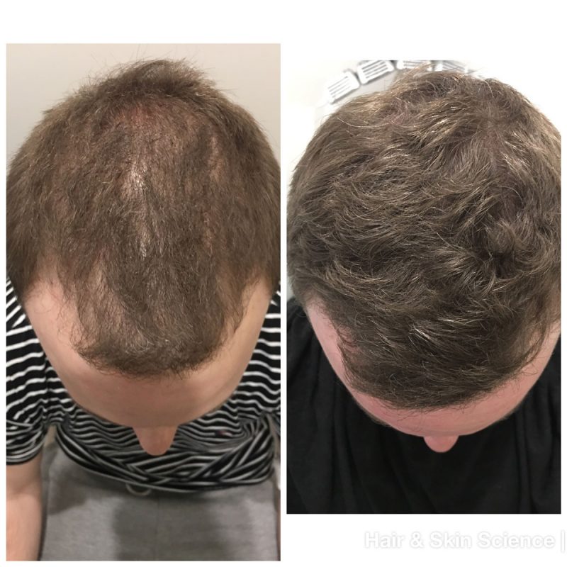 Before & Afters - Hair & Skin Science